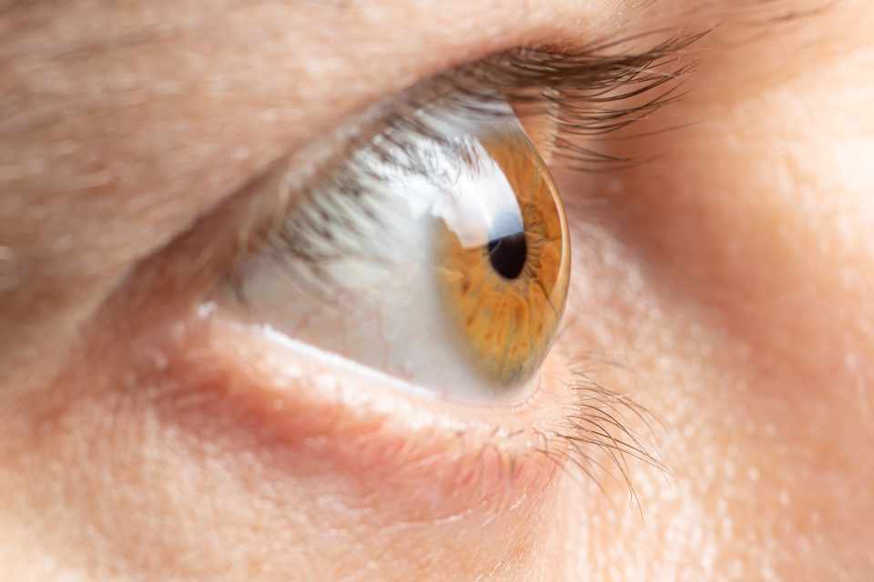 Citicoline – a potential supplement for preventing glaucoma